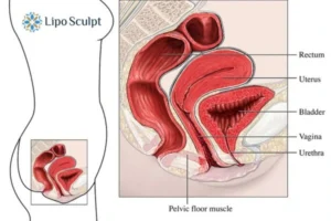 Treatment For A Leaky Bladder 2 How EM Chair treatment Oxford can help Leaky bladder issues. Read more now!