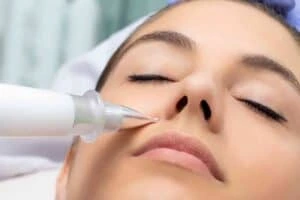 Best Actinic Keratoses Removal 3 Actinic keratoses Oxford solutions - book in today!