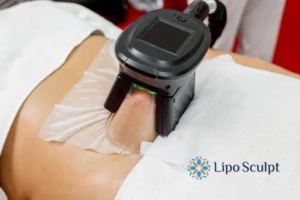 Does Fat Freezing At Home Work? 3 Fat freezing at home from Lipo Sculpt Oxford
